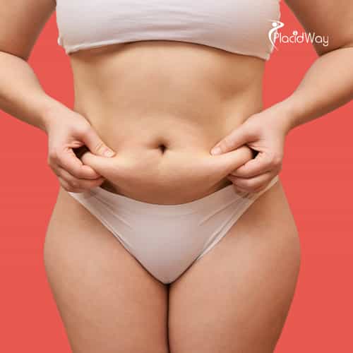 Tijuana’s Cross-Border 'Mommy Makeover' Packages: Saving US Patients $15,000 on Combined Care